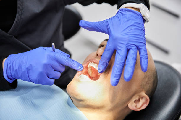Best Chipped Tooth Repair Near Me  in Estelle, LA